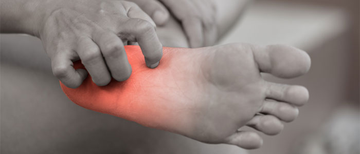 peripheral Neuropathy